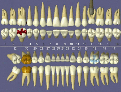3d charting practice web teeth charts