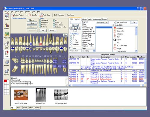 3d charting practice web tooth charting practice