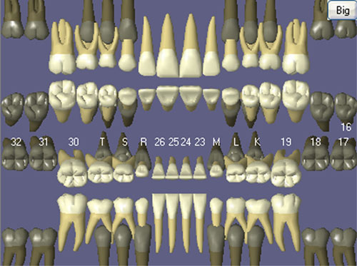 3d charting practice web charting mixed dentition