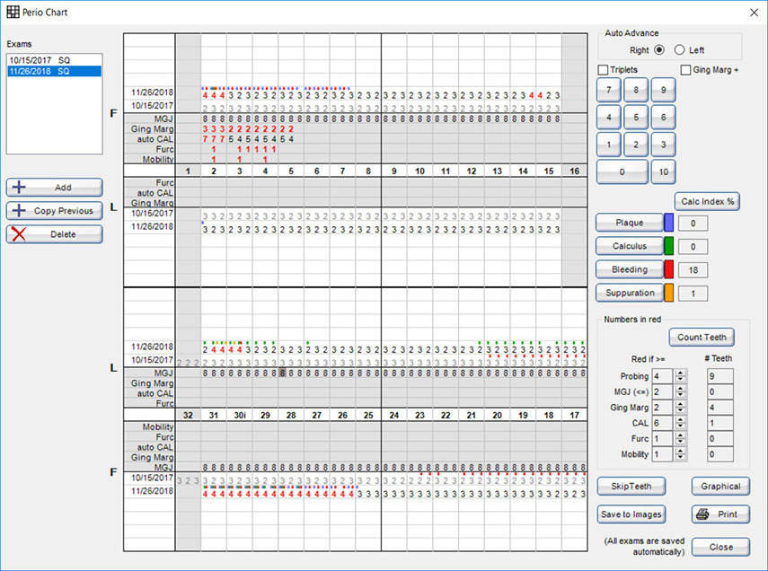 Perio Charting Form